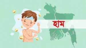 হাম ও উপসর্গে আরও ৯ শিশুর মৃত্যু
